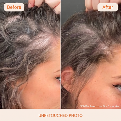 Longer, Stronger, Fuller Hair in 6 Weeks