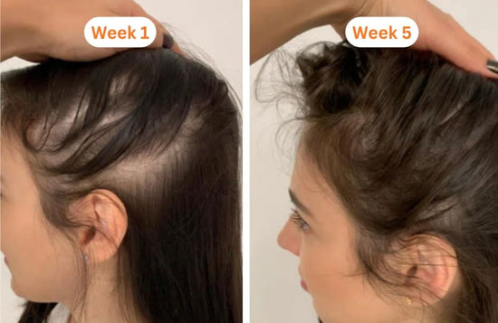 Before and after