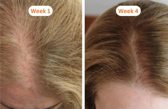 Before and after