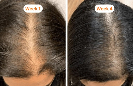 Before and after