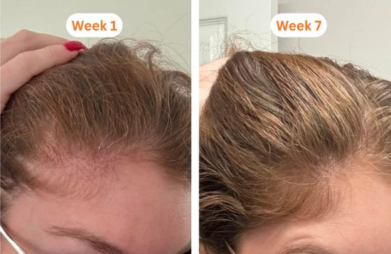 Before and after