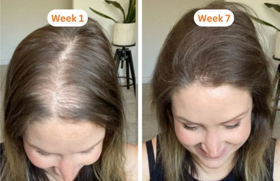 Before and after