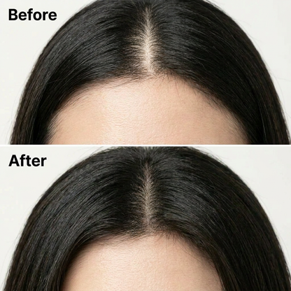 Korea's #1 Hair Growth Serum